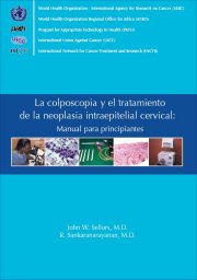 La colposcopia y el tratamiento de la neoplasia intraepitelial cervical