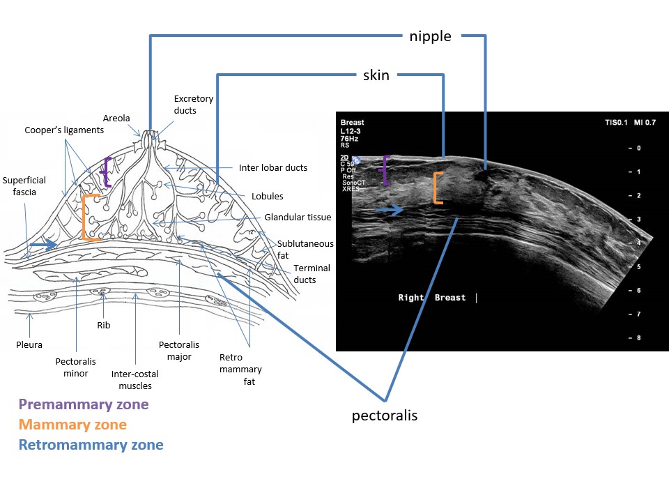 5: The gross and micro-anatomy of breast tissue: (a) Scanning the