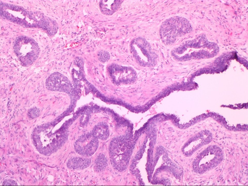 Female Breast Chart - Anatomy, Pathology and Self-Examination