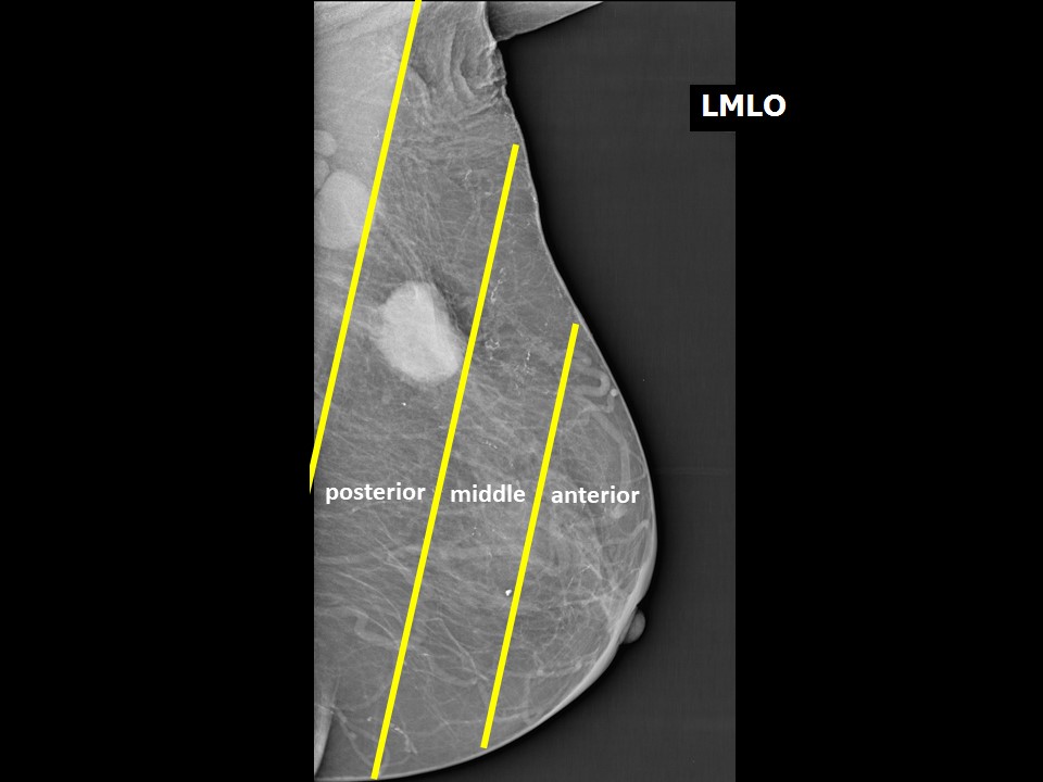 Atlas Of Breast Cancer Early Detection
