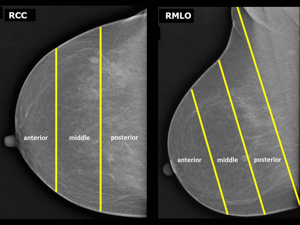 Atlas Of Breast Cancer Early Detection