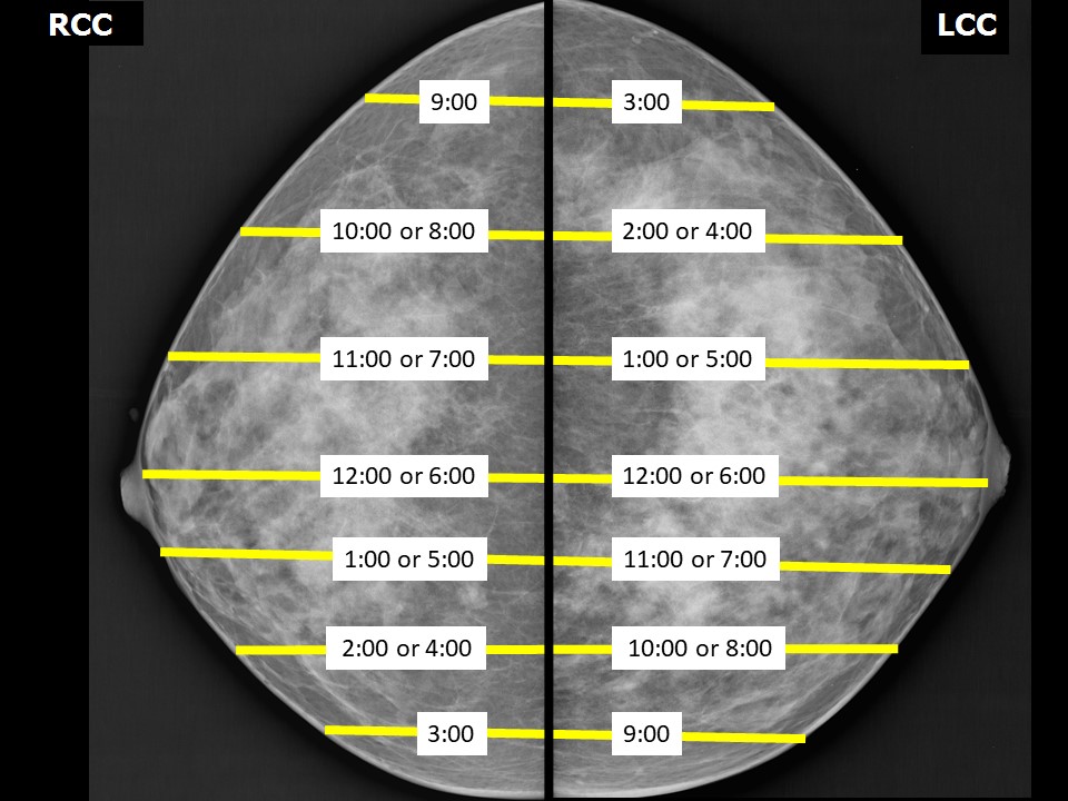 Atlas Of Breast Cancer Early Detection