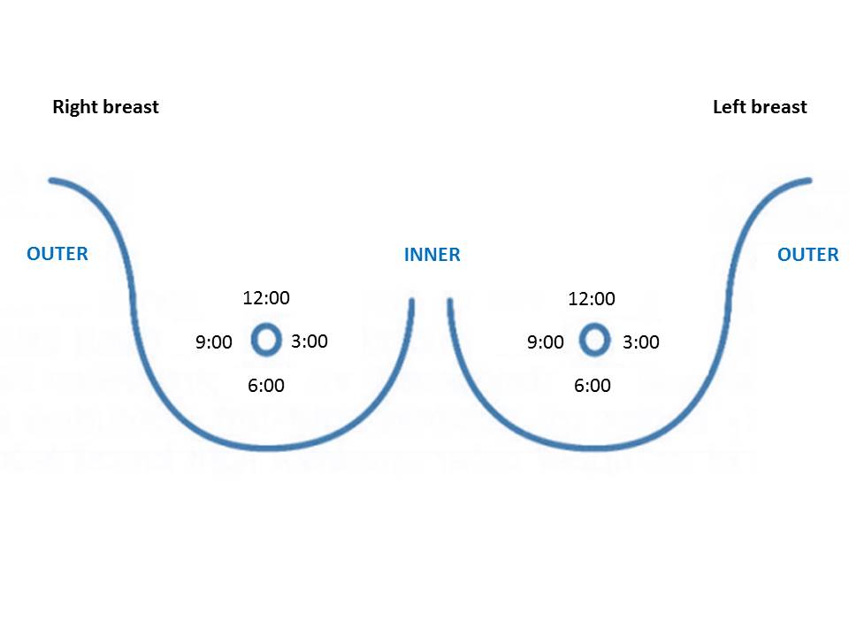 mammography-clock-positions-quadrants