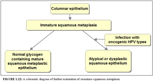 Metaplasia and dysplasia: Video, Anatomy & Definition