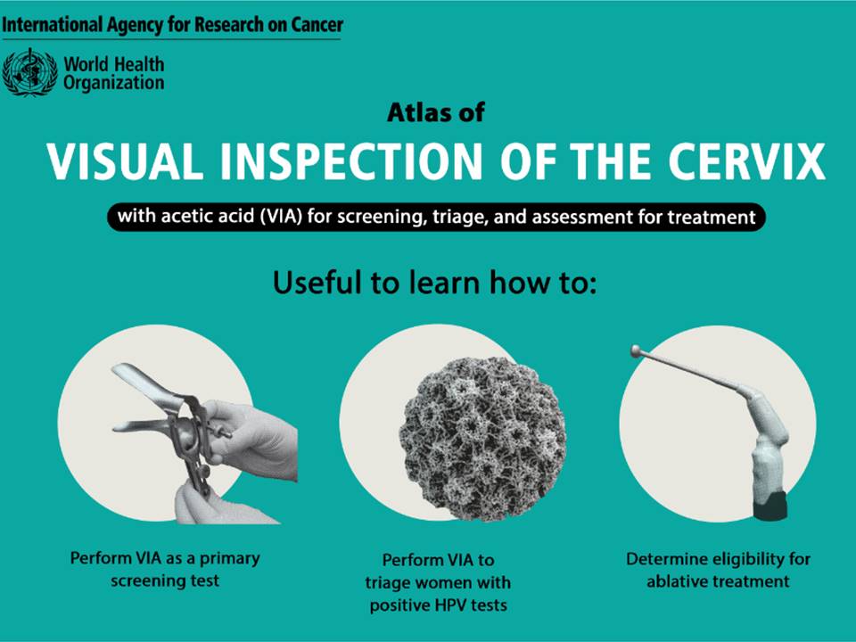 Atlas of visual inspection of the cervix with acetic acid for screening,  triage, and assessment for treatment