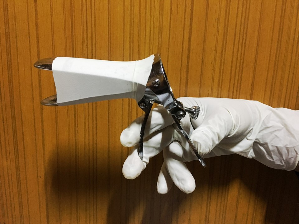 Atlas of visual inspection of the cervix with acetic acid for screening ...